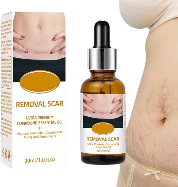 Acne Scar Removal Rejuvenation Serum | Scar, C Section & Stretch Mark Removal Oil For Women - Image 6