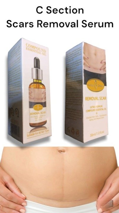 Acne Scar Removal Rejuvenation Serum | Scar, C Section & Stretch Mark Removal Oil For Women - Image 7