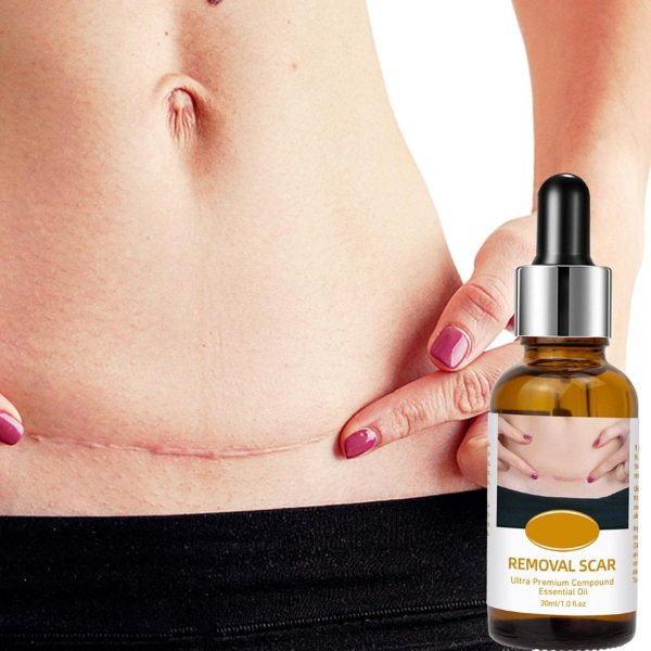 Acne Scar Removal Rejuvenation Serum | Scar, C Section & Stretch Mark Removal Oil For Women - Image 5