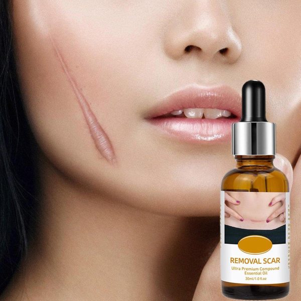 Acne Scar Removal Rejuvenation Serum | Scar, C Section & Stretch Mark Removal Oil For Women - Image 2