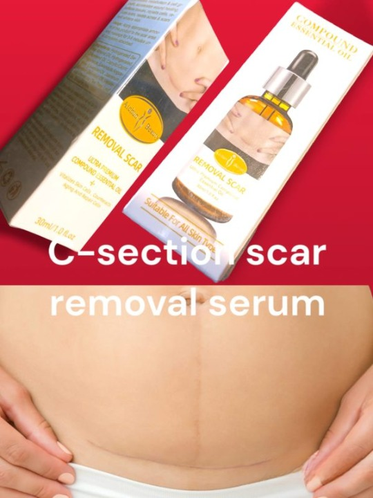 Acne Scar Removal Rejuvenation Serum | Scar, C Section & Stretch Mark Removal Oil For Women - Image 8