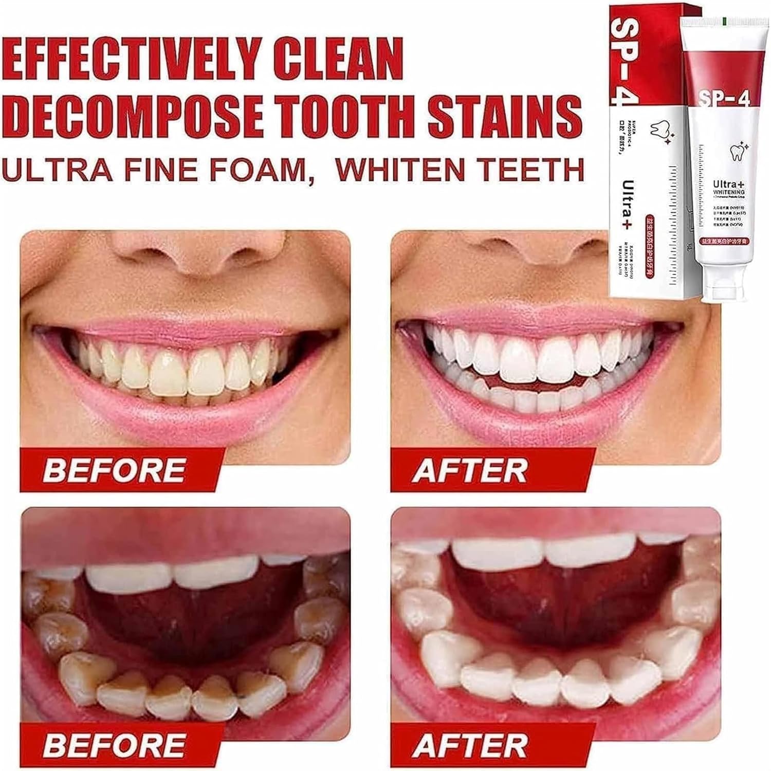 Yayashi Sp-4 Ultra Whitening Toothpaste Probiotic Stain Remover 120Gm / Stain Removing Toothpaste, Protects Gums Freshens Breath, for Everyone - Image 2